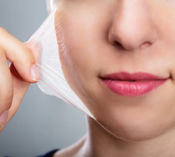 PEELING QUÍMICOS - TCA - SALICÍLICOS - AHA